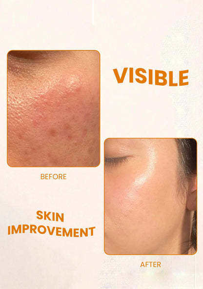 Glycolic Acid Toner