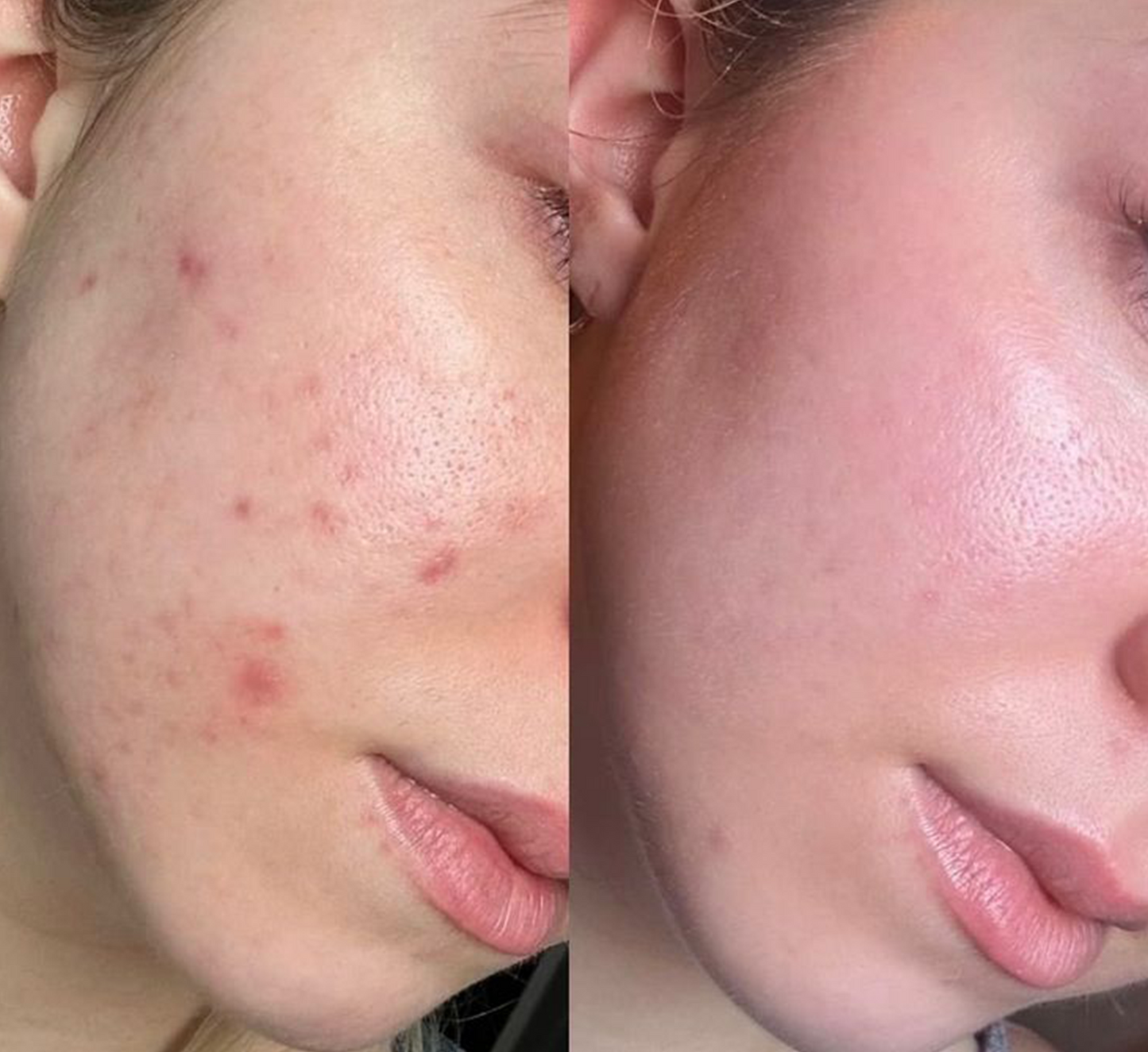 Exfoliating and Brightening Facewash